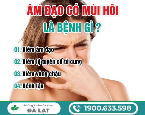 Hình ảnh minh họa